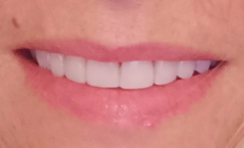 GF Diseño Dental - 2