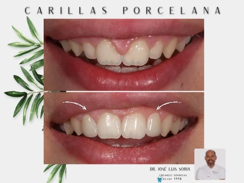IBLÚ DENTAL - Dr Jose Luis Soria - 2