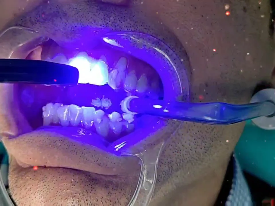 ITES DENTAL - 3