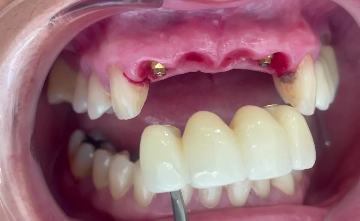 Lara & Ochoa Clínica Dental