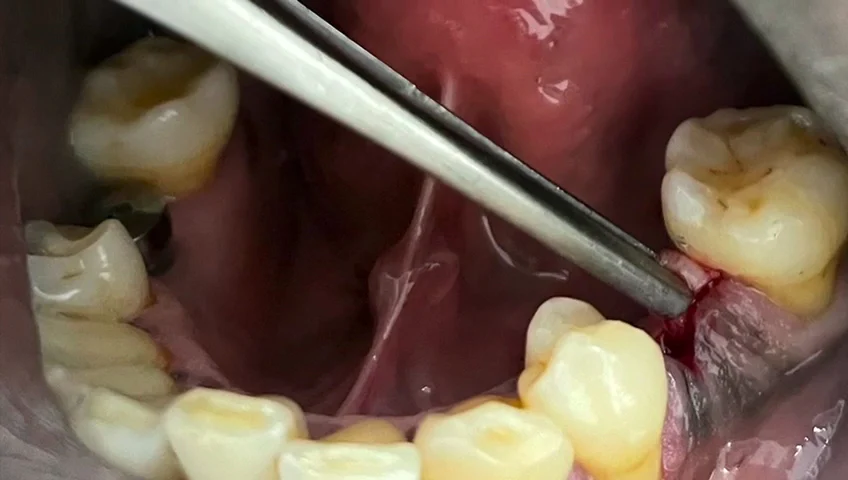 Mallorca Dental | Dentista en Palma - 2