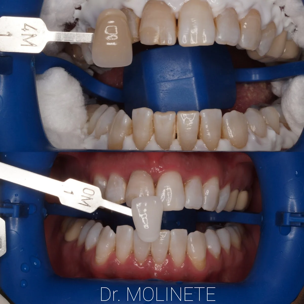 MOLYDENTAL Madrid - 3