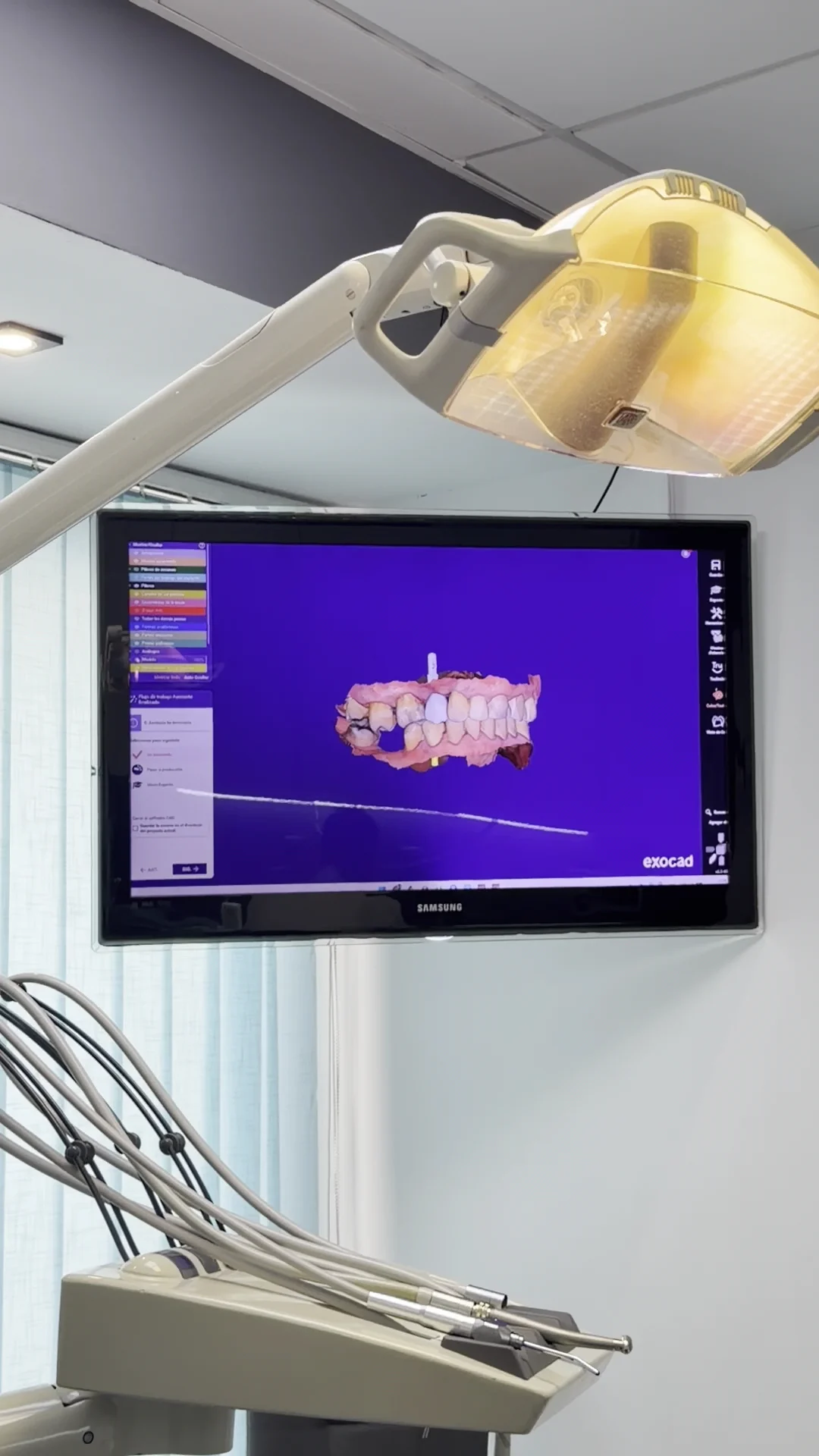 Odon The Smile Factory Especialistas en Prótesis Dental, Implantes Dentales y Ortodoncia Invisible - 2