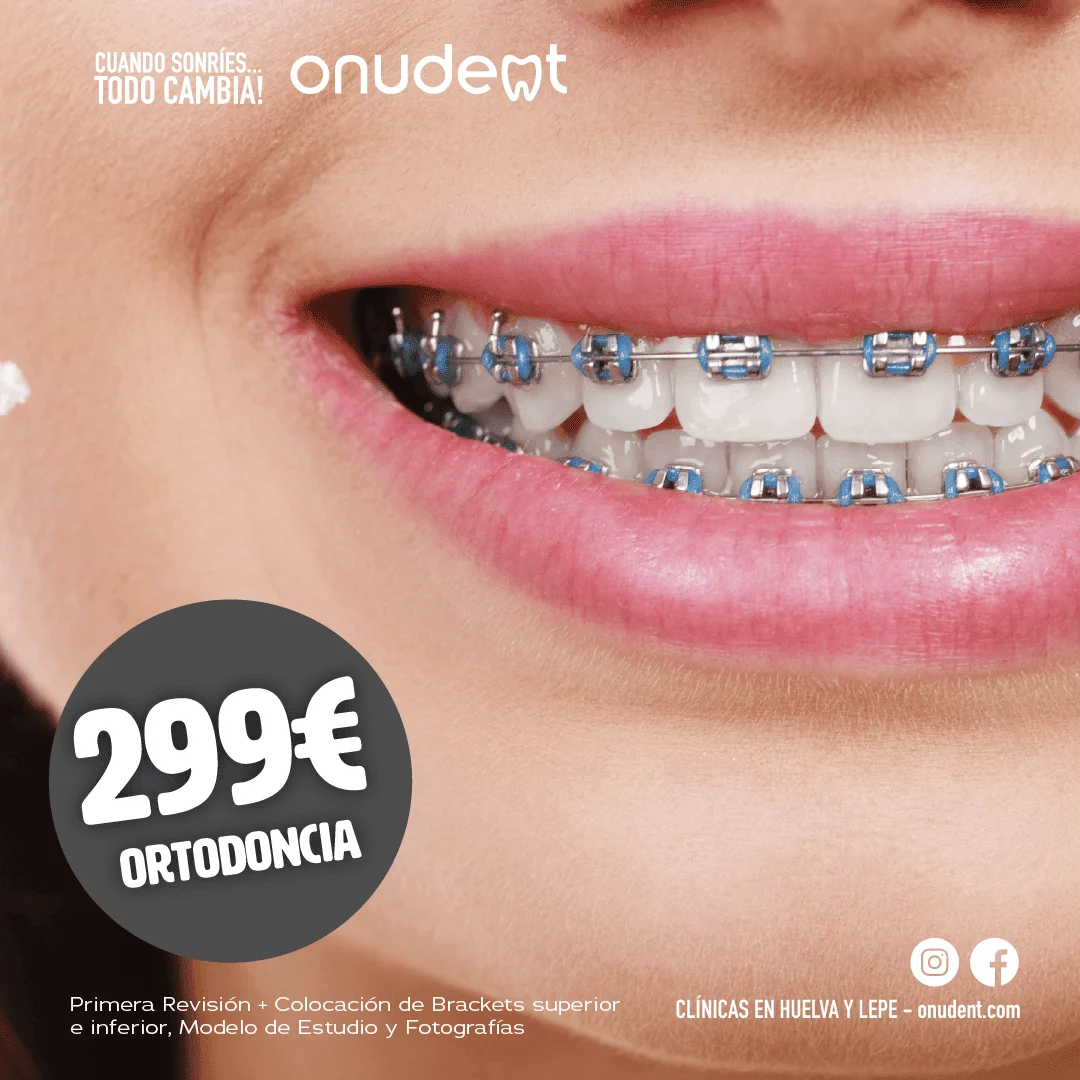 Onudent Lepe - 2