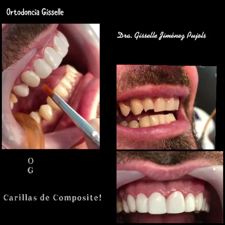 ORTODONCIA GISSELLE - 3