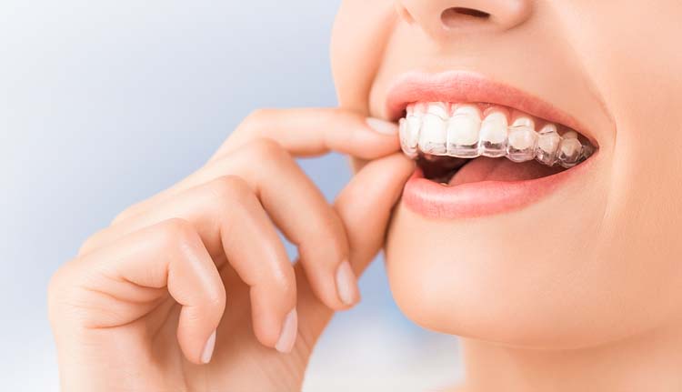precio invisalign