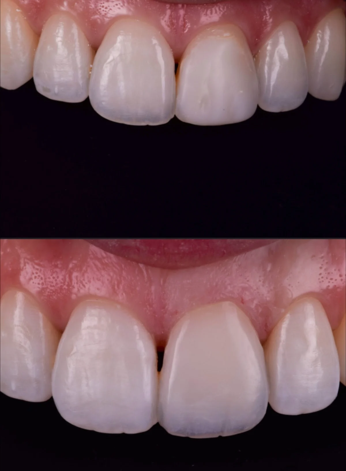 Paladio Clínica Dental Arganzuela | | Implantes Dentales sin Dolor | Ortodoncia en Madrid - 2