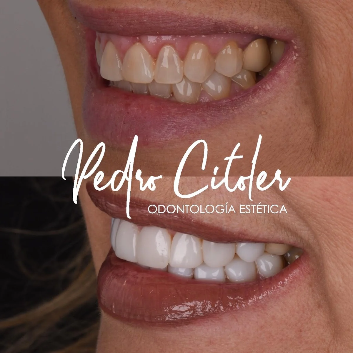 Pedro Citoler Odontología Estética - 2