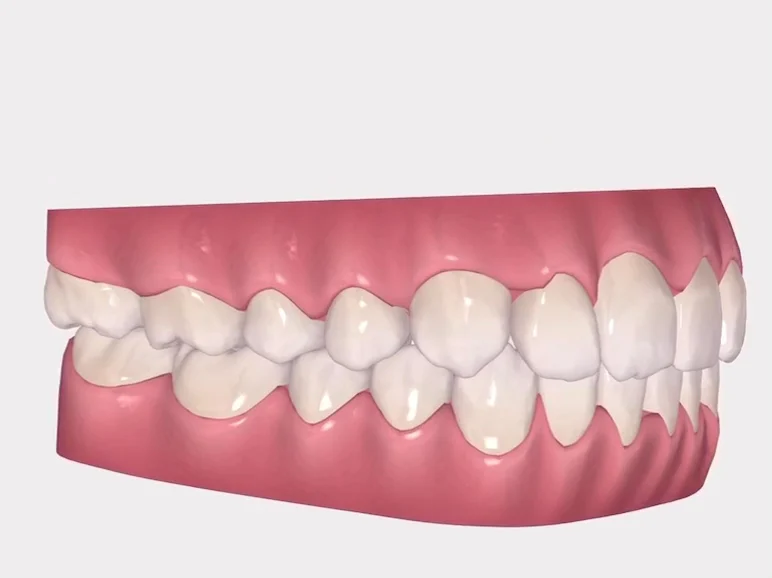 Pedro Citoler Odontología Estética - 3