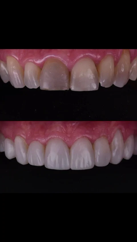 Pedro Citoler Odontología Estética - 4