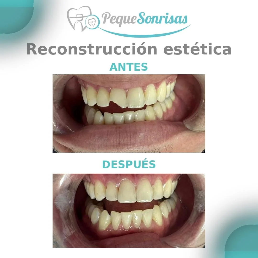 PequeSonrisas Clínica Dental sant cugat - 2
