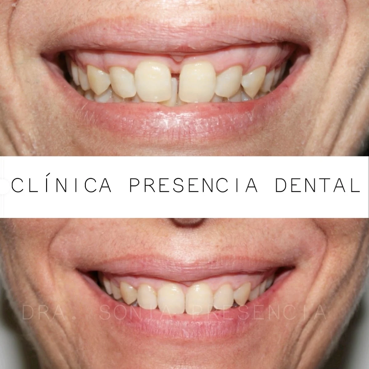 Presencia Dental - 2