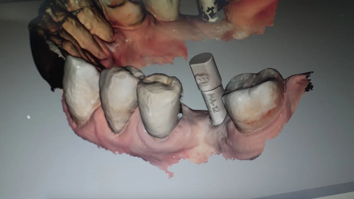 PROPDENTAL | Clínica Dental en Badalona - 2