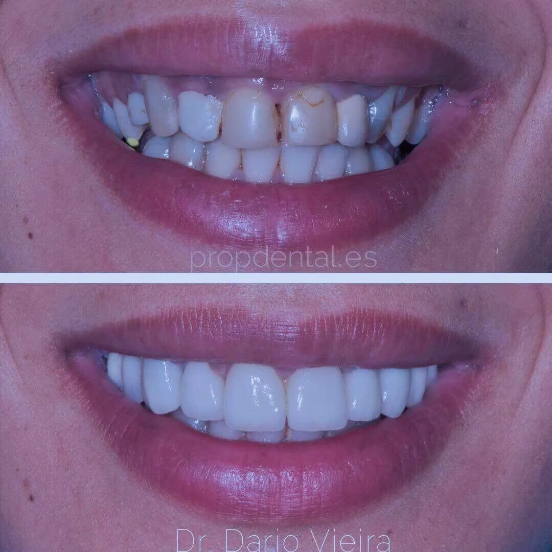 PROPDENTAL | Clínica Dental en Hospitalet - 4