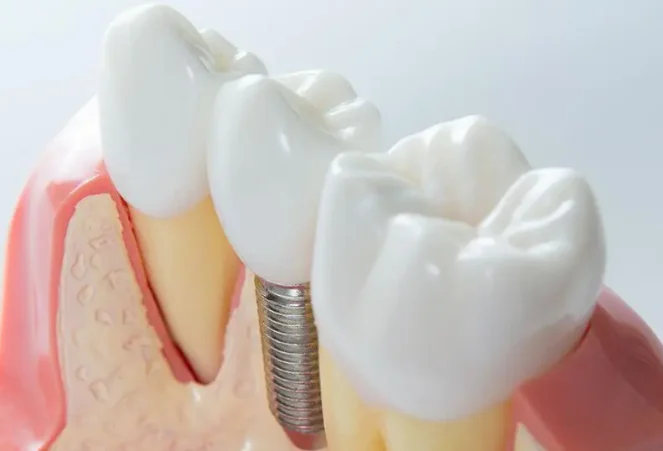Rosasco Dental - 2