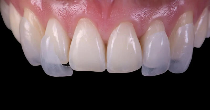 Sagunt Dental SL - 2