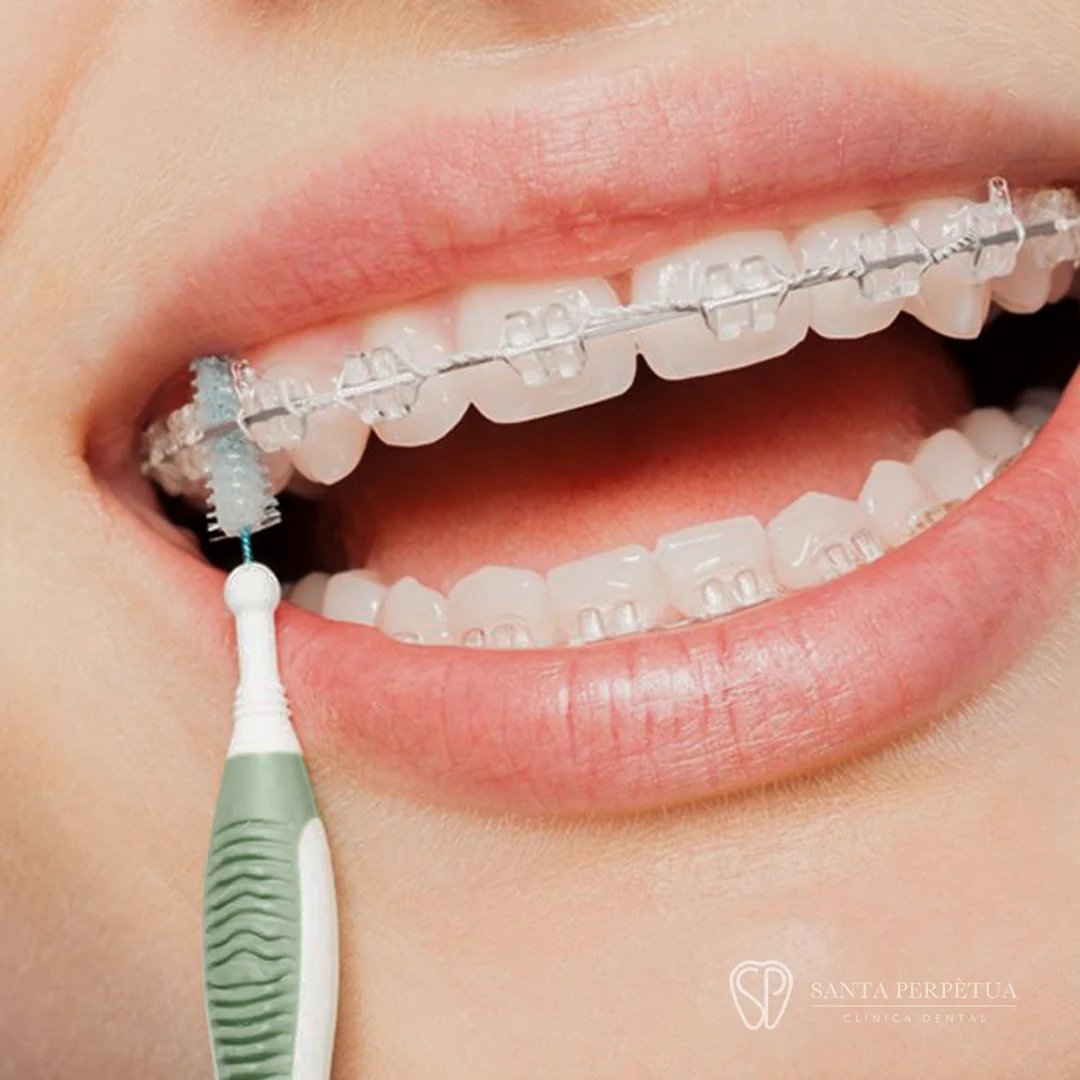 Santa Perpètua Clínica Dental - 2