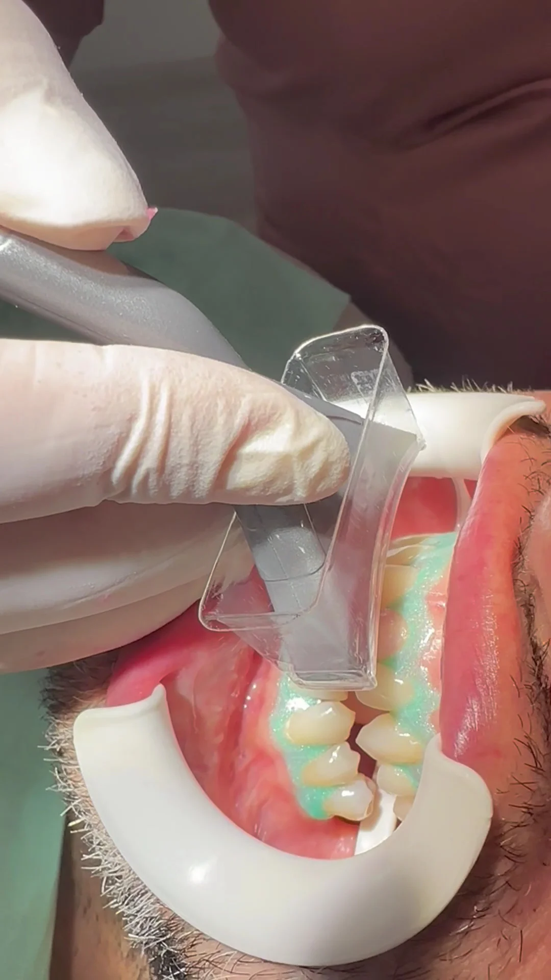 SDS Clínica Dental- dentista Vilafranca del Penedès - 3