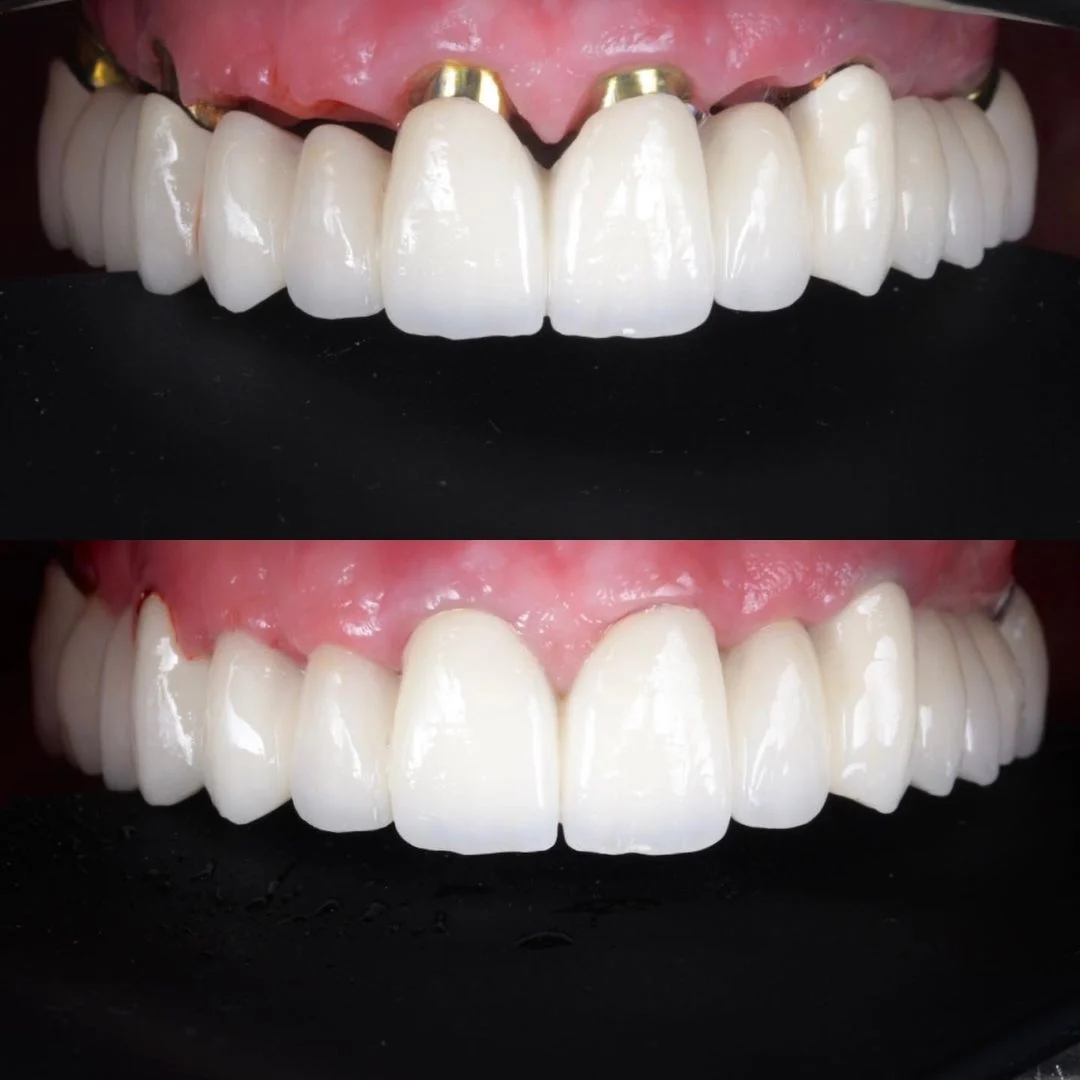 Smart Dental - 2