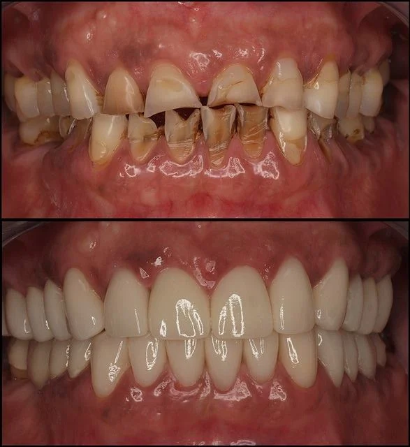 Sonria Clinica Dental Dr. Febrer - 3