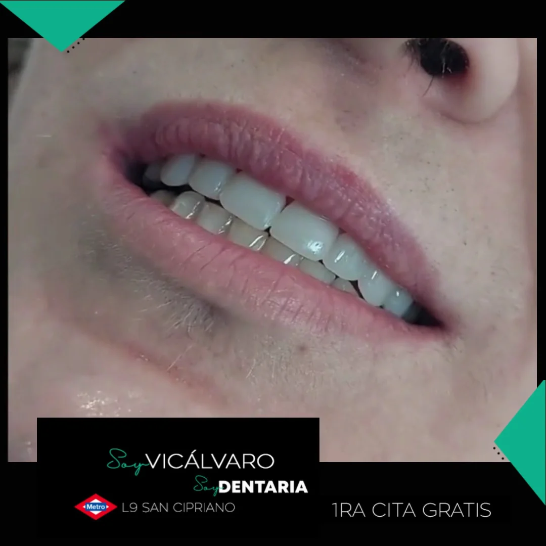 Soy Dentaria | Vicálvaro - 2