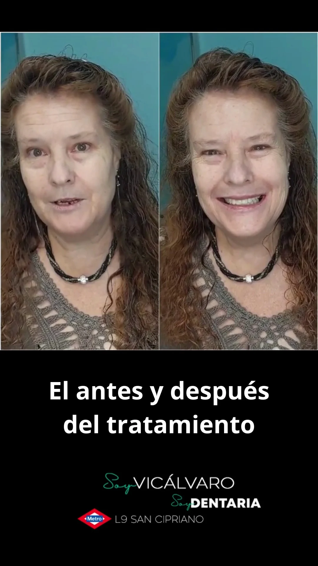 Soy Dentaria | Vicálvaro - 3