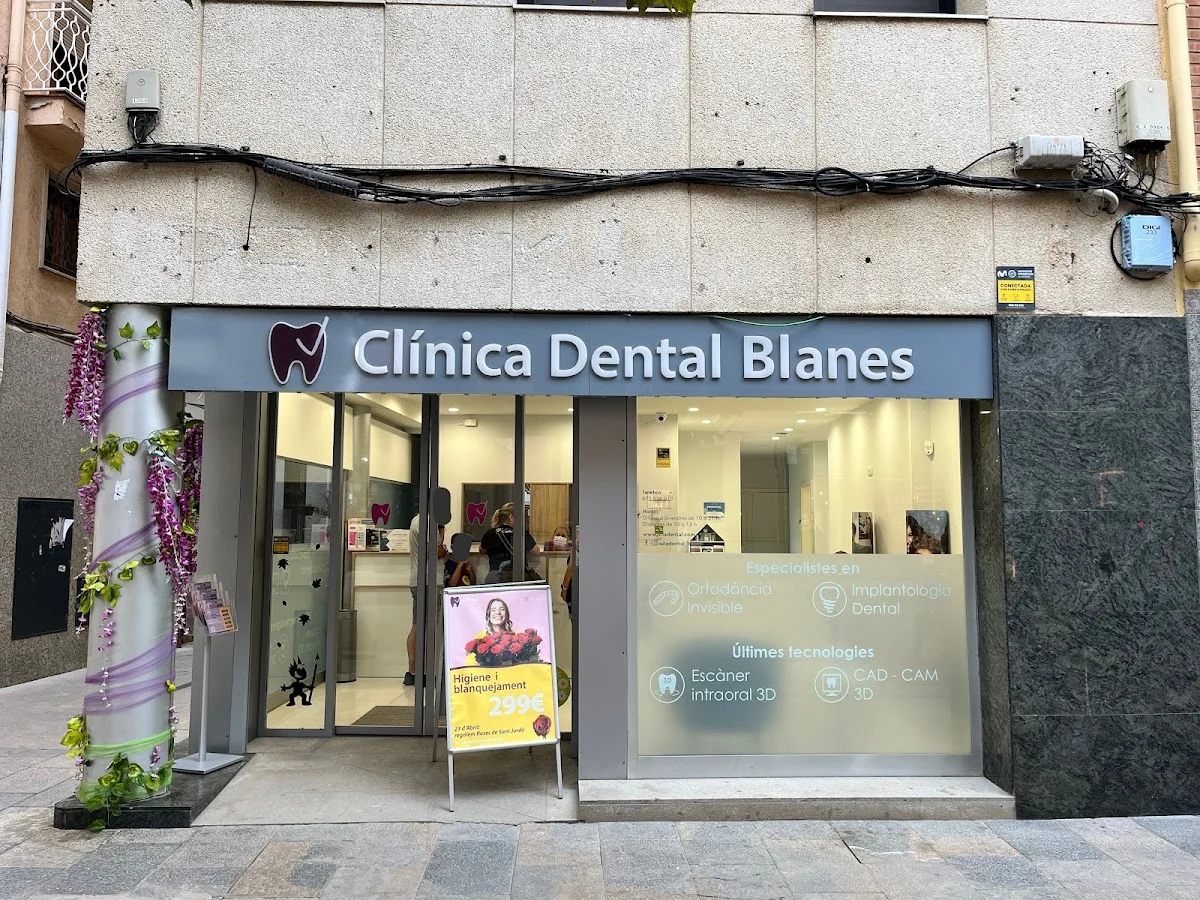 Vila Dental - Clínica Dental Blanes