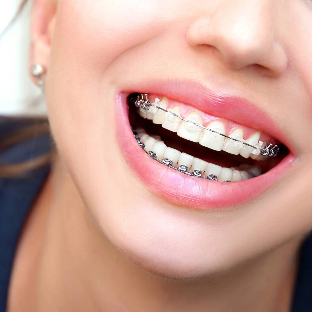 VILLACASTÍN - Clínica Dental y Medicina Estética - Implantes - Ortodoncia invisible - Carillas - Botox - Depilación láser - 4