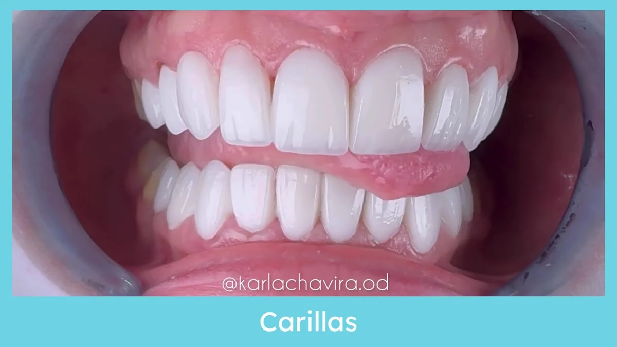 WOW SMILE STUDIO | Clínica Dental Barcelona | Ortodoncia Invisible | Carillas Dentales - 3