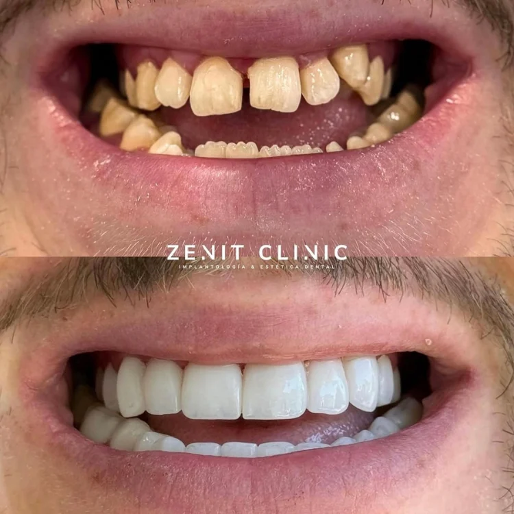 Zenit Clinic | Clínica Dental - 2